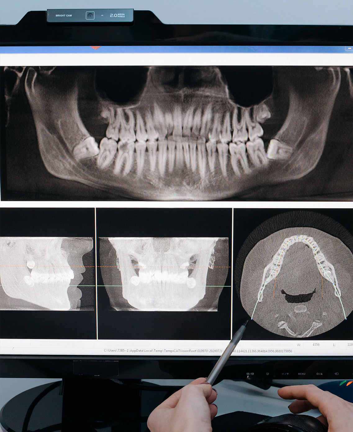 Digital X-Rays